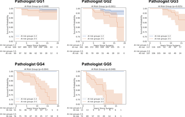 Figure 3 for Predicting Prostate Cancer-Specific Mortality with A.I.-based Gleason Grading