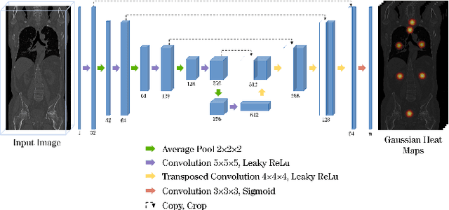 Figure 2 for A unified 3D framework for Organs at Risk Localization and Segmentation for Radiation Therapy Planning