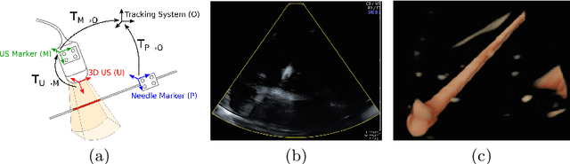 Figure 1 for Similarity Registration Problems for 2D/3D Ultrasound Calibration