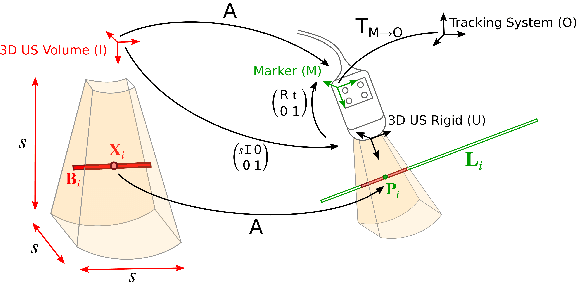 Figure 3 for Similarity Registration Problems for 2D/3D Ultrasound Calibration
