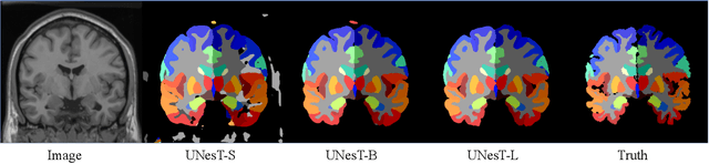 Figure 4 for UNesT: Local Spatial Representation Learning with Hierarchical Transformer for Efficient Medical Segmentation