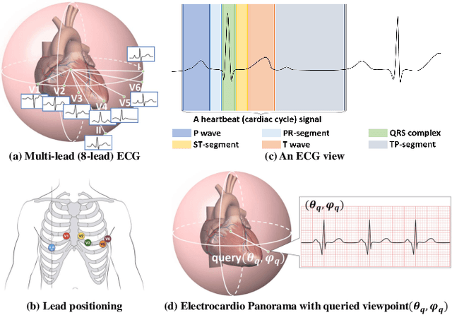 Figure 1 for Electrocardio Panorama: Synthesizing New ECG Views with Self-supervision