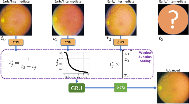Figure 1 for Development and Validation of a Novel Prognostic Model for Predicting AMD Progression Using Longitudinal Fundus Images