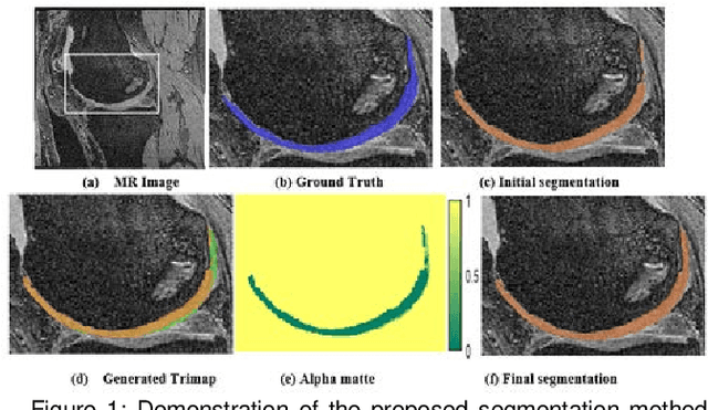 Figure 1 for Multipath CNN with alpha matte inference for knee tissue segmentation from MRI
