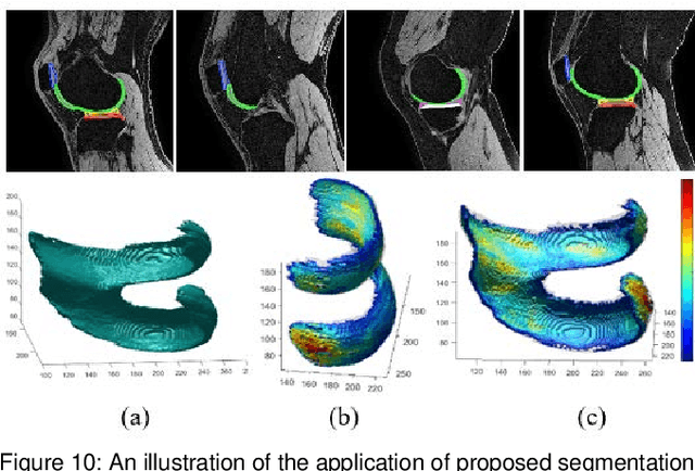 Figure 2 for Multipath CNN with alpha matte inference for knee tissue segmentation from MRI