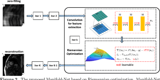 Figure 3 for Deep Manifold Learning for Dynamic MR Imaging