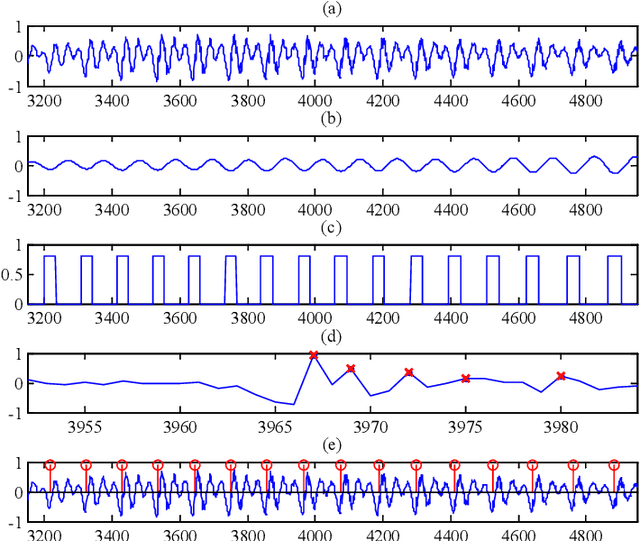 Figure 2 for A Waveform Representation Framework for High-quality Statistical Parametric Speech Synthesis