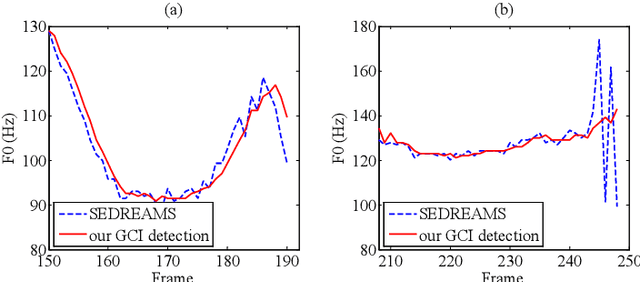 Figure 3 for A Waveform Representation Framework for High-quality Statistical Parametric Speech Synthesis