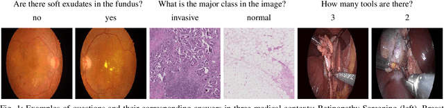 Figure 1 for A Question-Centric Model for Visual Question Answering in Medical Imaging