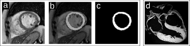 Figure 1 for A study of CNN capacity applied to Left Venticle Segmentation in Cardiac MRI