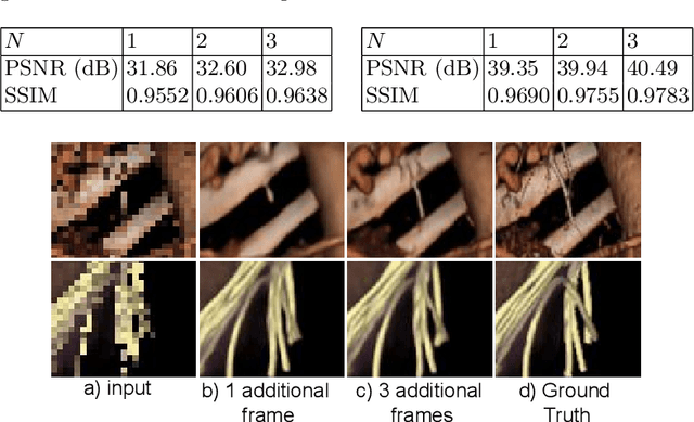 Figure 3 for Deep Learning based Super-Resolution for Medical Volume Visualization with Direct Volume Rendering