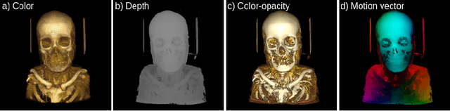 Figure 4 for Deep Learning based Super-Resolution for Medical Volume Visualization with Direct Volume Rendering