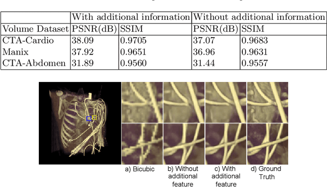 Figure 1 for Deep Learning based Super-Resolution for Medical Volume Visualization with Direct Volume Rendering