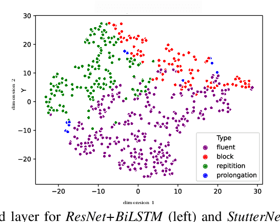 Figure 3 for StutterNet: Stuttering Detection Using Time Delay Neural Network