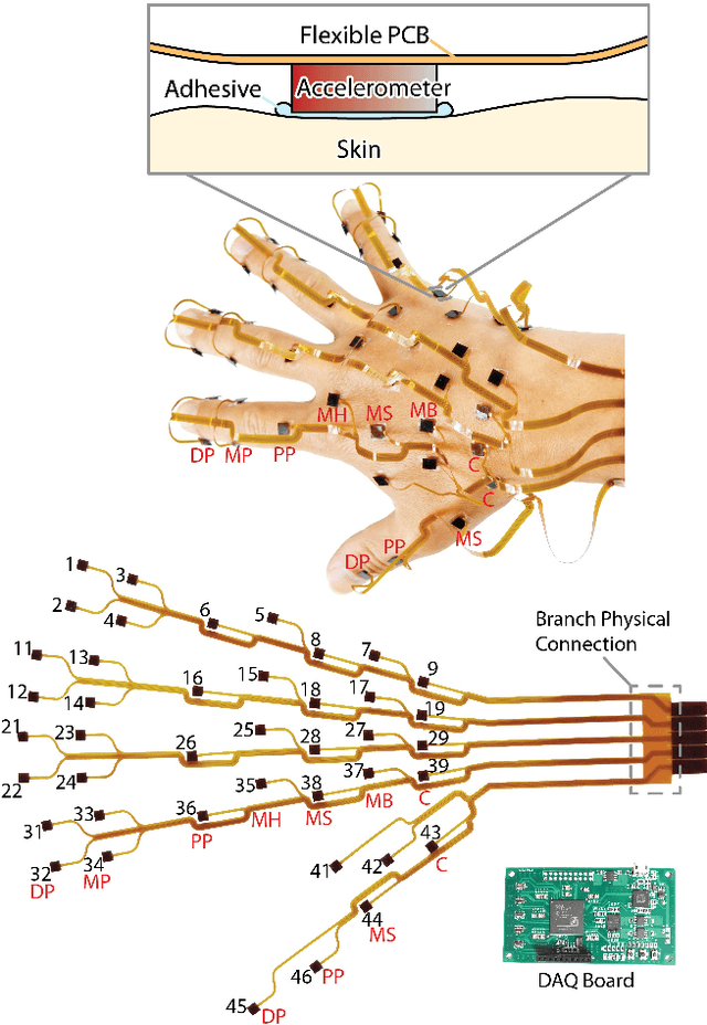 Figure 1 for A Wearable Tactile Sensor Array for Large Area Remote Vibration Sensing in the Hand