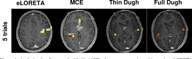 Figure 4 for Efficient Hierarchical Bayesian Inference for Spatio-temporal Regression Models in Neuroimaging