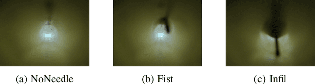 Figure 2 for Deep Learning for Needle Detection in a Cannulation Simulator