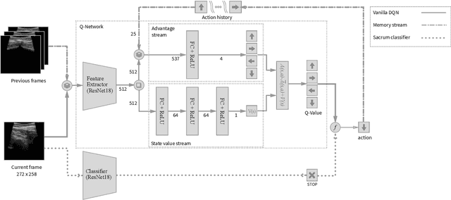 Figure 2 for Ultrasound-Guided Robotic Navigation with Deep Reinforcement Learning