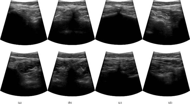 Figure 3 for Ultrasound-Guided Robotic Navigation with Deep Reinforcement Learning