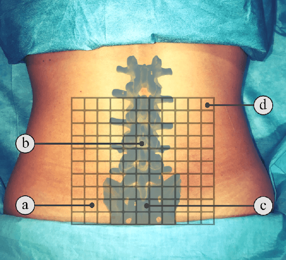 Figure 4 for Ultrasound-Guided Robotic Navigation with Deep Reinforcement Learning