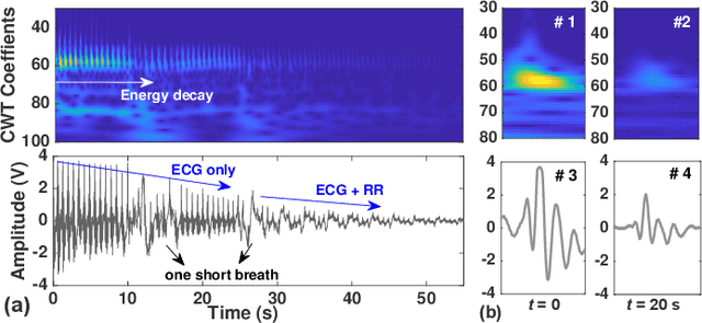 Figure 2 for High-Sensitivity Electric Potential Sensors for Non-Contact Monitoring of Physiological Signals