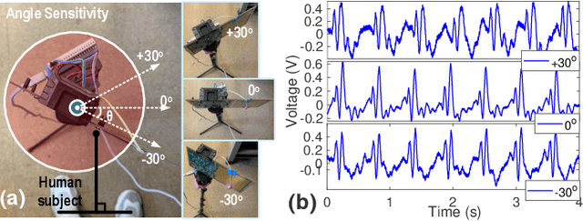 Figure 3 for High-Sensitivity Electric Potential Sensors for Non-Contact Monitoring of Physiological Signals