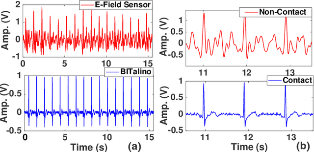 Figure 4 for High-Sensitivity Electric Potential Sensors for Non-Contact Monitoring of Physiological Signals