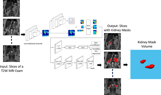 Figure 1 for Automated Kidney Segmentation by Mask R-CNN in T2-weighted Magnetic Resonance Imaging