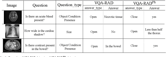 Figure 3 for MuVAM: A Multi-View Attention-based Model for Medical Visual Question Answering