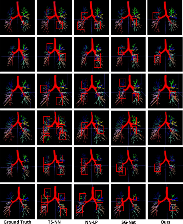 Figure 4 for BronchusNet: Region and Structure Prior Embedded Representation Learning for Bronchus Segmentation and Classification
