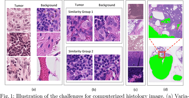 Figure 1 for ScanNet: A Fast and Dense Scanning Framework for Metastatic Breast Cancer Detection from Whole-Slide Images