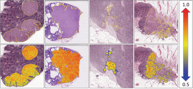 Figure 4 for ScanNet: A Fast and Dense Scanning Framework for Metastatic Breast Cancer Detection from Whole-Slide Images