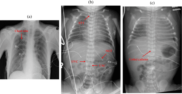 Figure 2 for Computer-Aided Assessment of Catheters and Tubes on Radiographs: How Good is Artificial Intelligence for Assessment?