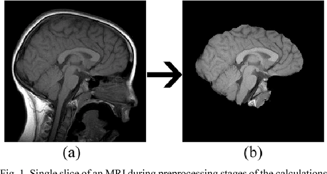 Figure 1 for Web Based Brain Volume Calculation for Magnetic Resonance Images