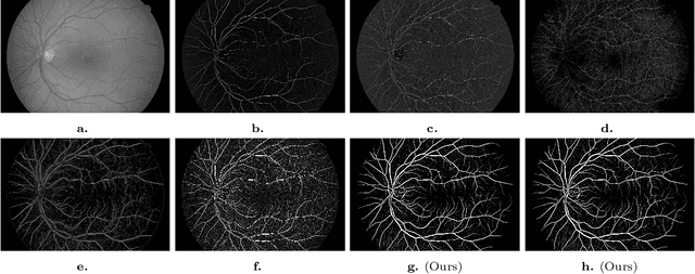 Figure 3 for 2D and 3D Vascular Structures Enhancement via Multiscale Fractional Anisotropy Tensor