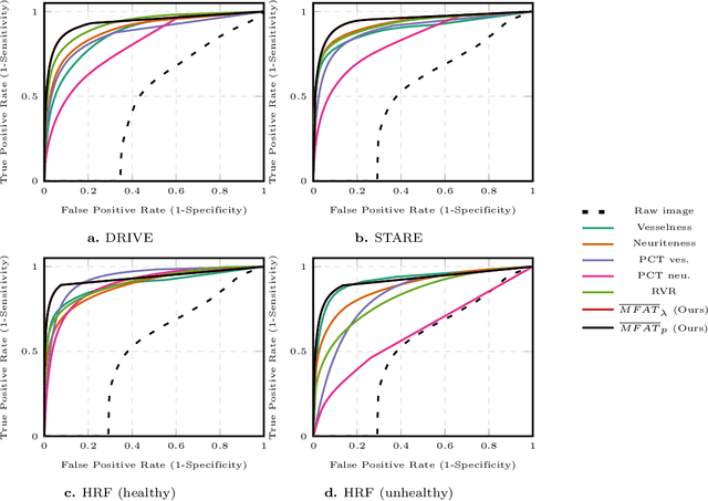 Figure 4 for 2D and 3D Vascular Structures Enhancement via Multiscale Fractional Anisotropy Tensor