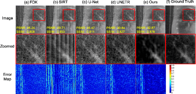 Figure 3 for Adaptively Re-weighting Multi-Loss Untrained Transformer for Sparse-View Cone-Beam CT Reconstruction