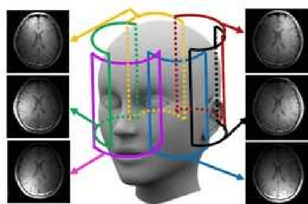 Figure 4 for Tracking Tensor Subspaces with Informative Random Sampling for Real-Time MR Imaging