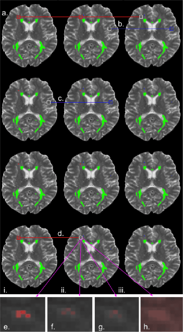 Figure 3 for Exploring Uncertainty Measures in Deep Networks for Multiple Sclerosis Lesion Detection and Segmentation