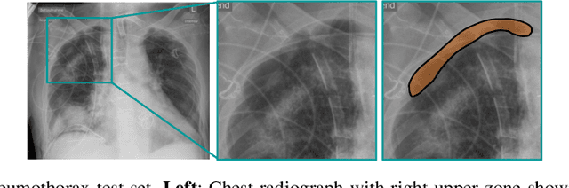 Figure 4 for Self-supervised Learning from 100 Million Medical Images