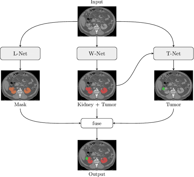 Figure 1 for End-to-End Cascaded U-Nets with a Localization Network for Kidney Tumor Segmentation