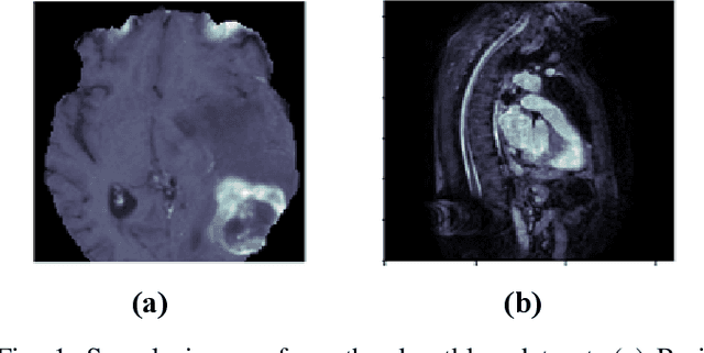 Figure 1 for Implementation of a Modified U-Net for Medical Image Segmentation on Edge Devices