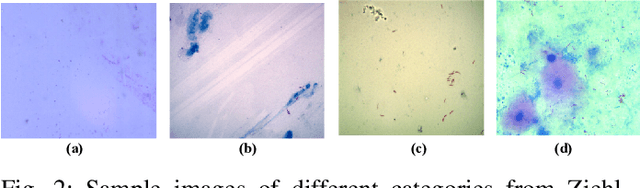 Figure 2 for Implementation of a Modified U-Net for Medical Image Segmentation on Edge Devices