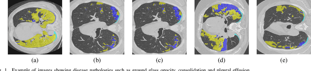 Figure 1 for CT Image Synthesis Using Weakly Supervised Segmentation and Geometric Inter-Label Relations For COVID Image Analysis