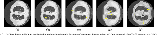 Figure 2 for CT Image Synthesis Using Weakly Supervised Segmentation and Geometric Inter-Label Relations For COVID Image Analysis