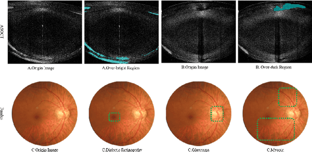 Figure 1 for Attention-based Saliency Hashing for Ophthalmic Image Retrieval