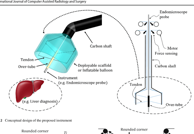 Figure 2 for A cable-driven parallel manipulator with force sensing capabilities for high-accuracy tissue endomicroscopy