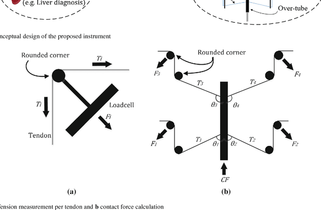 Figure 3 for A cable-driven parallel manipulator with force sensing capabilities for high-accuracy tissue endomicroscopy
