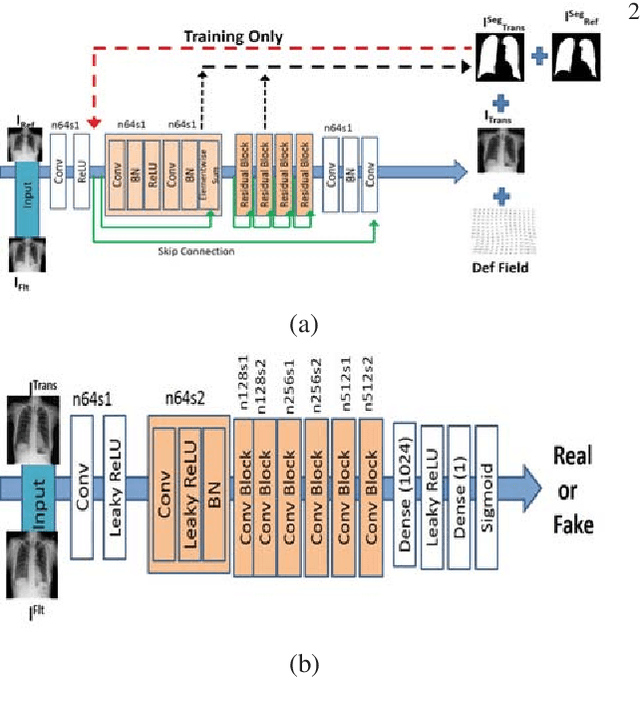 Figure 1 for Training Data Independent Image Registration With GANs Using Transfer Learning And Segmentation Information