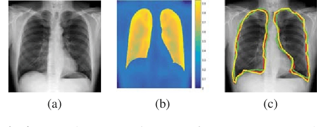 Figure 3 for Training Data Independent Image Registration With GANs Using Transfer Learning And Segmentation Information